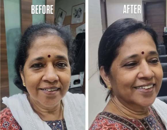 Bridal Makeup in Kilpauk, Chennai